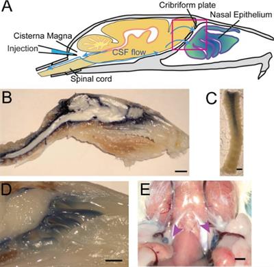 The Brain-Nose Interface: A Potential Cerebrospinal Fluid Clearance Site in Humans